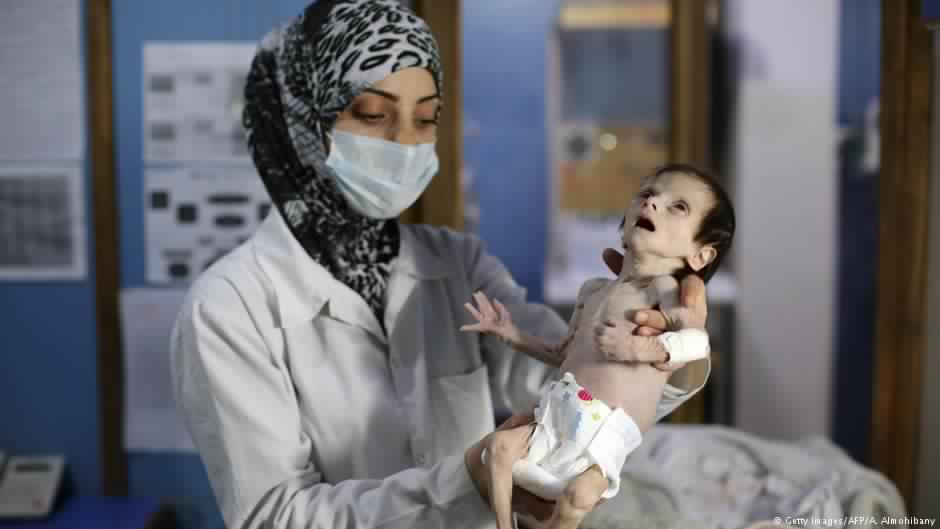 ai-un-malnutrition-marketexpress-in